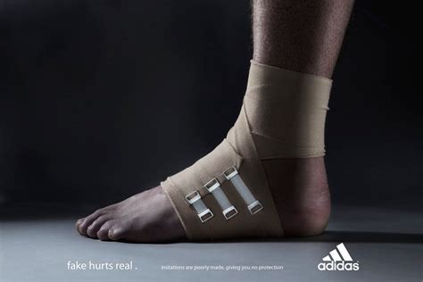 fake hurts real adidas